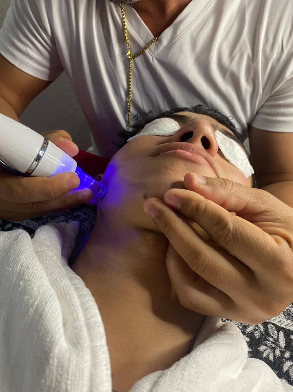 LIMPIEZA FACIAL PROFUNDA CON MICRODERMOABRASIÓN  - 1